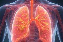 What is Chylothorax? Symptoms, Causes, and Treatment at a Lung Clinic Singapore